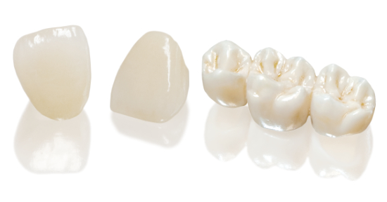 CÁC LOẠI RĂNG SỨ PHỔ BIẾN NHẤT HIỆN NAY SỬ DỤNG TRONG PHỤC HÌNH RĂNG. NÊN CHỌN LOẠI NÀO? 4 Răng sứ Titan