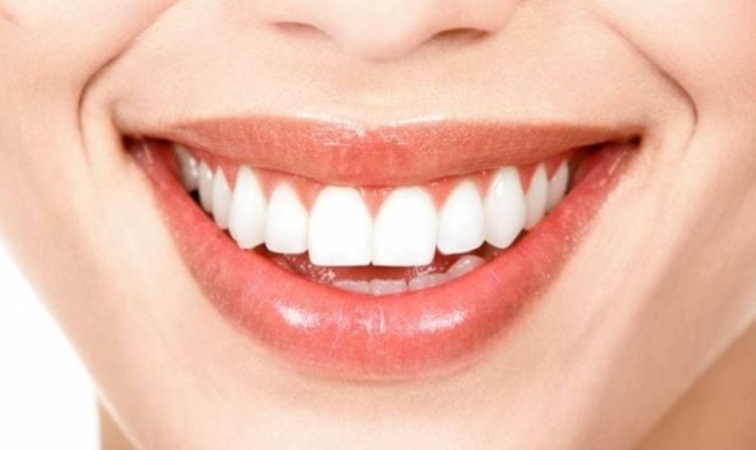 TOP 4 FORM RĂNG SỨ ĐƯỢC KHÁCH HÀNG ƯA CHUỘNG NHẤT HIỆN NAY GIÚP NỤ CƯỜI TỎA SÁNG 3 TOP 4 FORM RĂNG SỨ ĐƯỢC KHÁCH HÀNG ƯA CHUỘNG NHẤT HIỆN NAY GIÚP NỤ CƯỜI TỎA SÁNG