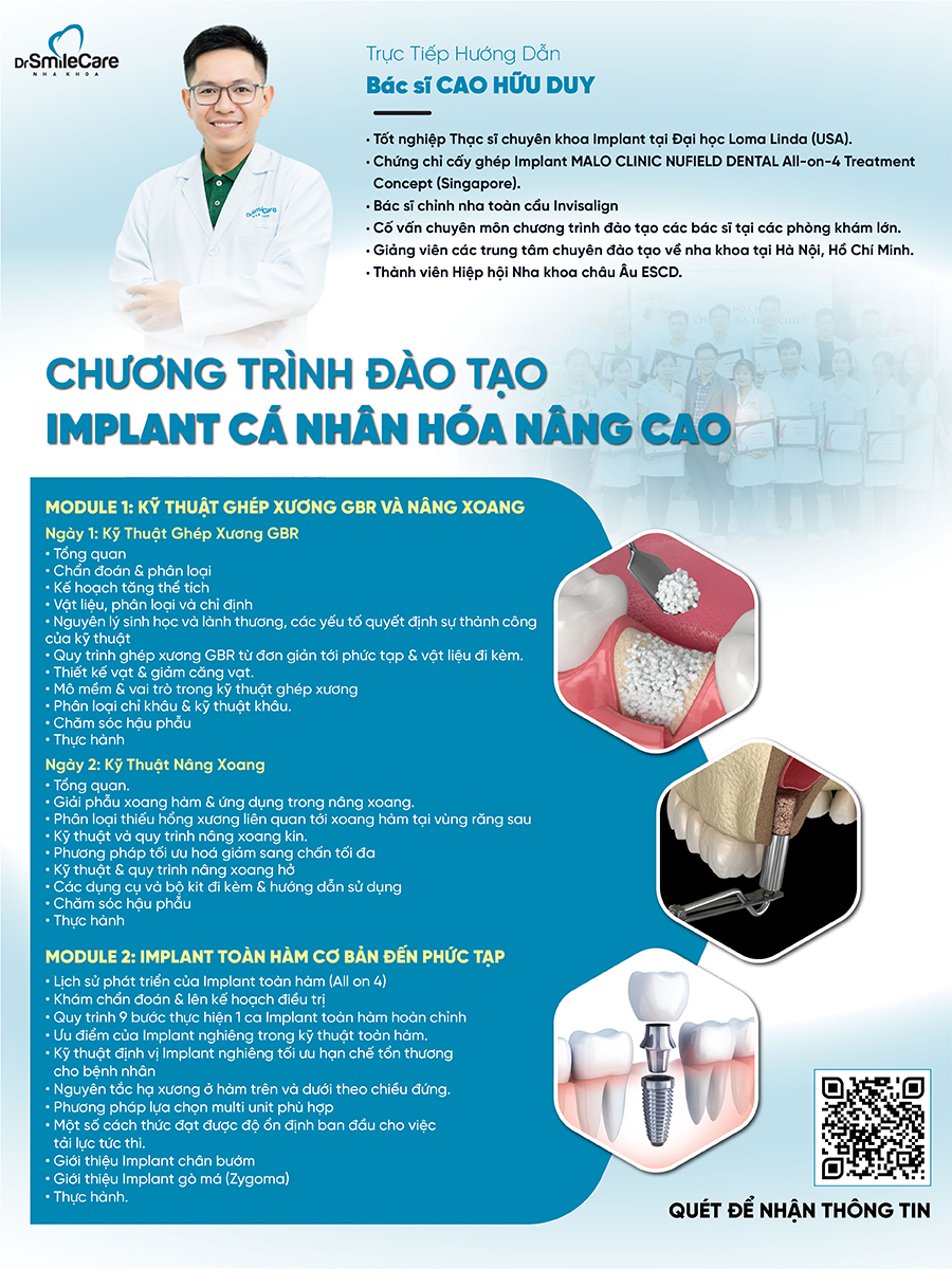 CHƯƠNG TRÌNH ĐÀO TẠO IMPLANT CÁ NHÂN HÓA DO TRỰC TIẾP BÁC SĨ CAO HỮU DUY GIẢNG DẠY 1 CHUONG TRINH DAO TAO FA 01