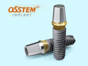 CÁC LOẠI TRỤ IMPLANT TỐT NHẤT TẠI NHA KHOA DR.SMILECARE – GIẢI PHÁP PHỤC HỒI RĂNG TOÀN DIỆN 1 Implant Osstem