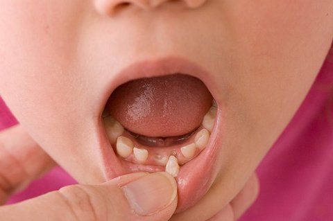 Lộ trình thay răng sữa tham khảo