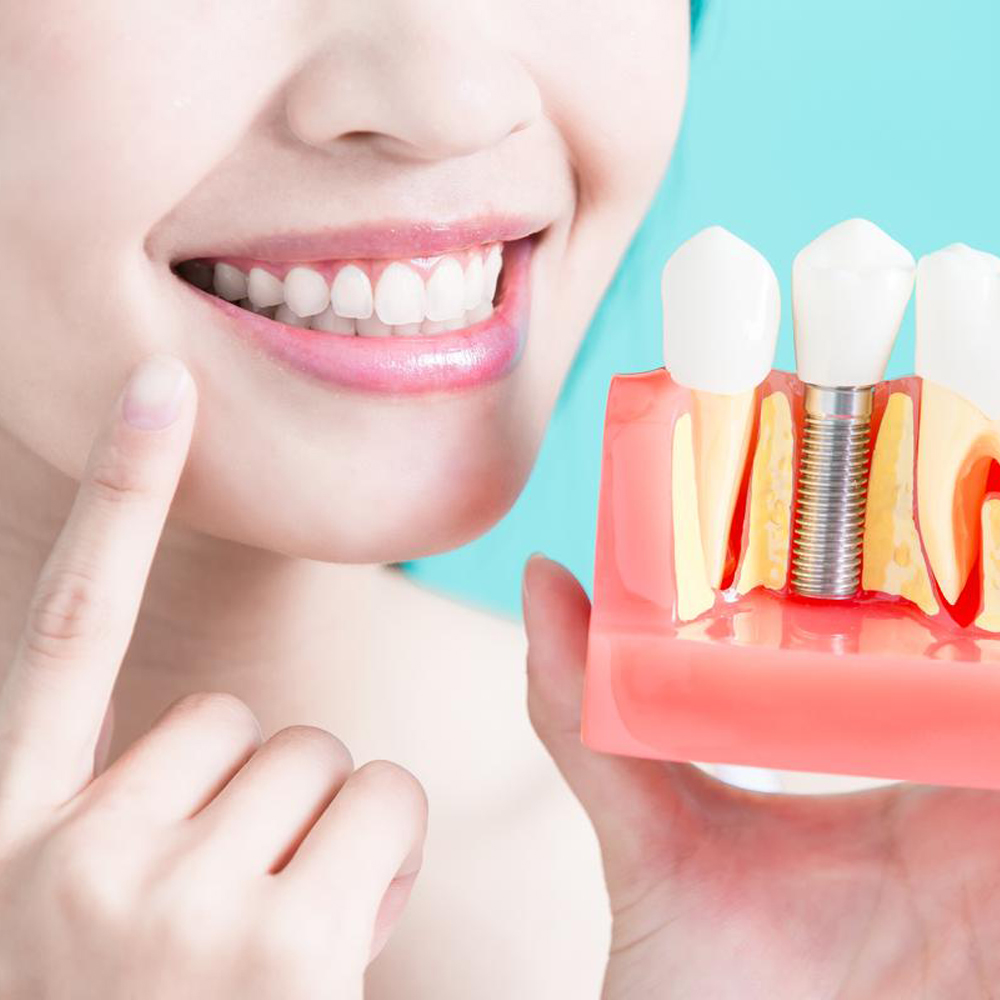 NHA KHOA DR.SMILECARE - CẤY GHÉP IMPLANT CÓ ĐIỂM VƯỢT TRỘI NÀO? 11 Trong rang implant