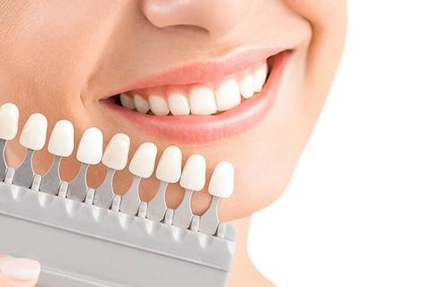 Smile Design Là Gì? Thiết Kế Nụ Cười Cá Nhân Hóa Hợp Gương Mặt 7 Vì sao răng đẹp riêng lẻ chưa chắc tạo nên nụ cười đẹp?