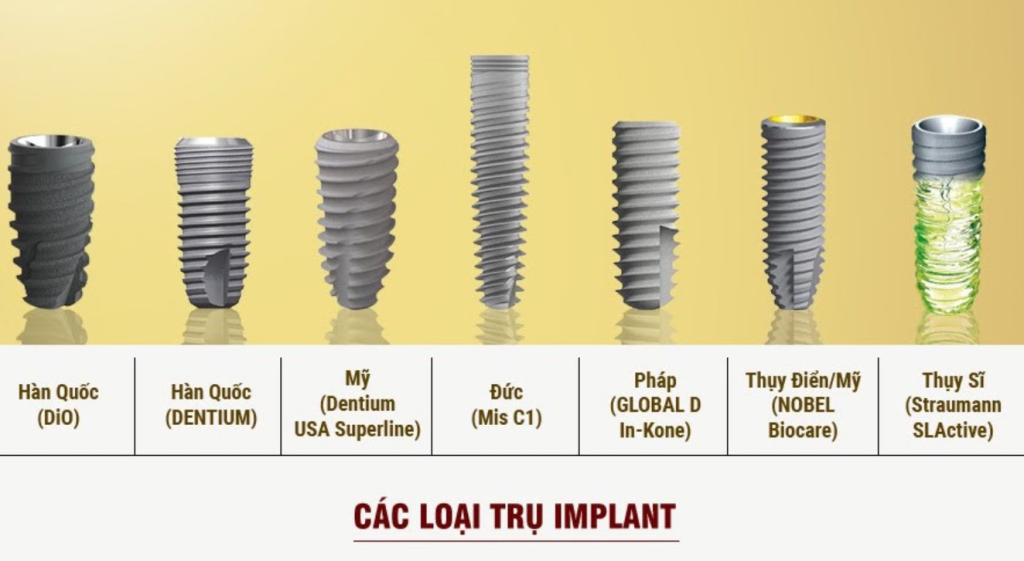 Vì sao chất liệu trụ Implant quyết định tuổi thọ cả hàm răng